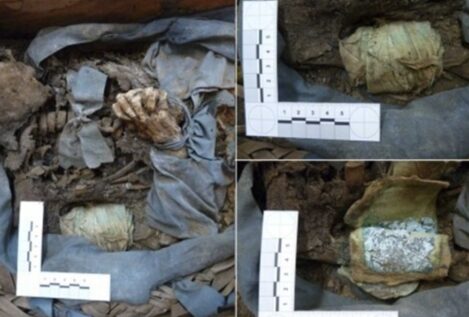 Desvelan cómo se trataba la enfermedad y el ritual funerario en el siglo XIX en Madrid