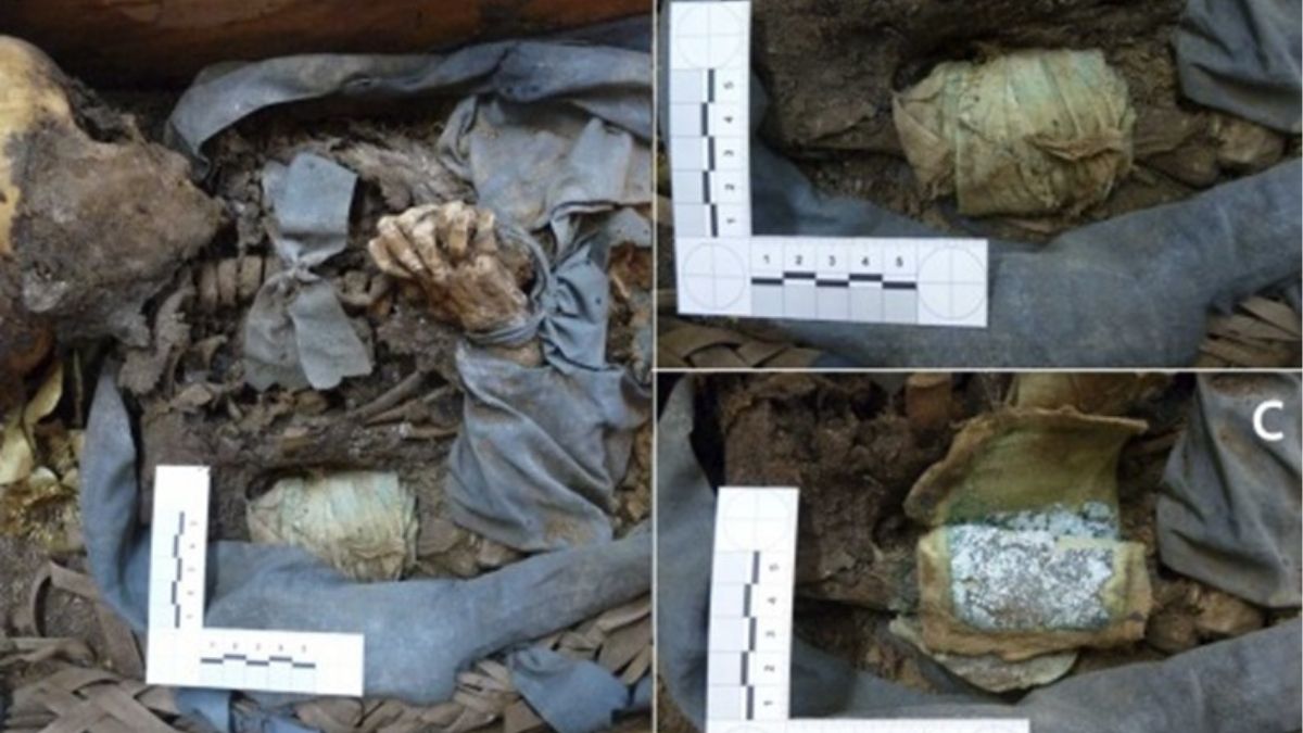 Desvelan cómo se trataba la enfermedad y el ritual funerario en el siglo XIX en Madrid