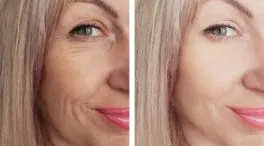 Ni cremas, ni tratamientos: este es el alimento que ayuda a reducir las arrugas de forma natural