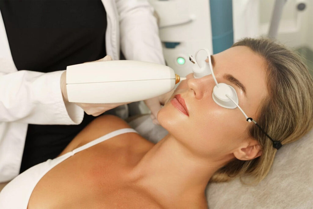 Tratamiento de Luz Pulsada IPL (Fuente: Clínica Velázquez)