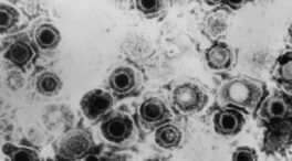 Descubren un antiviral contra el herpes que vence la resistencia a las curas actuales