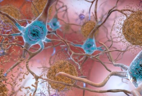 El alzhéimer, ¿una enfermedad infecciosa?