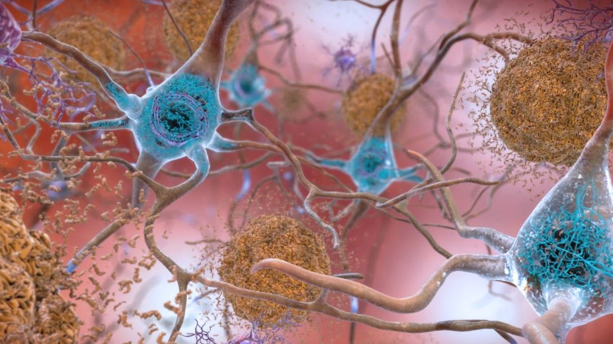 El alzhéimer, ¿una enfermedad infecciosa?