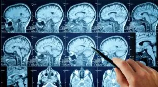 Identifican las señales cerebrales del olvido de recuerdos desagradables
