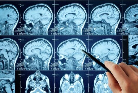 Identifican las señales cerebrales del olvido de recuerdos desagradables