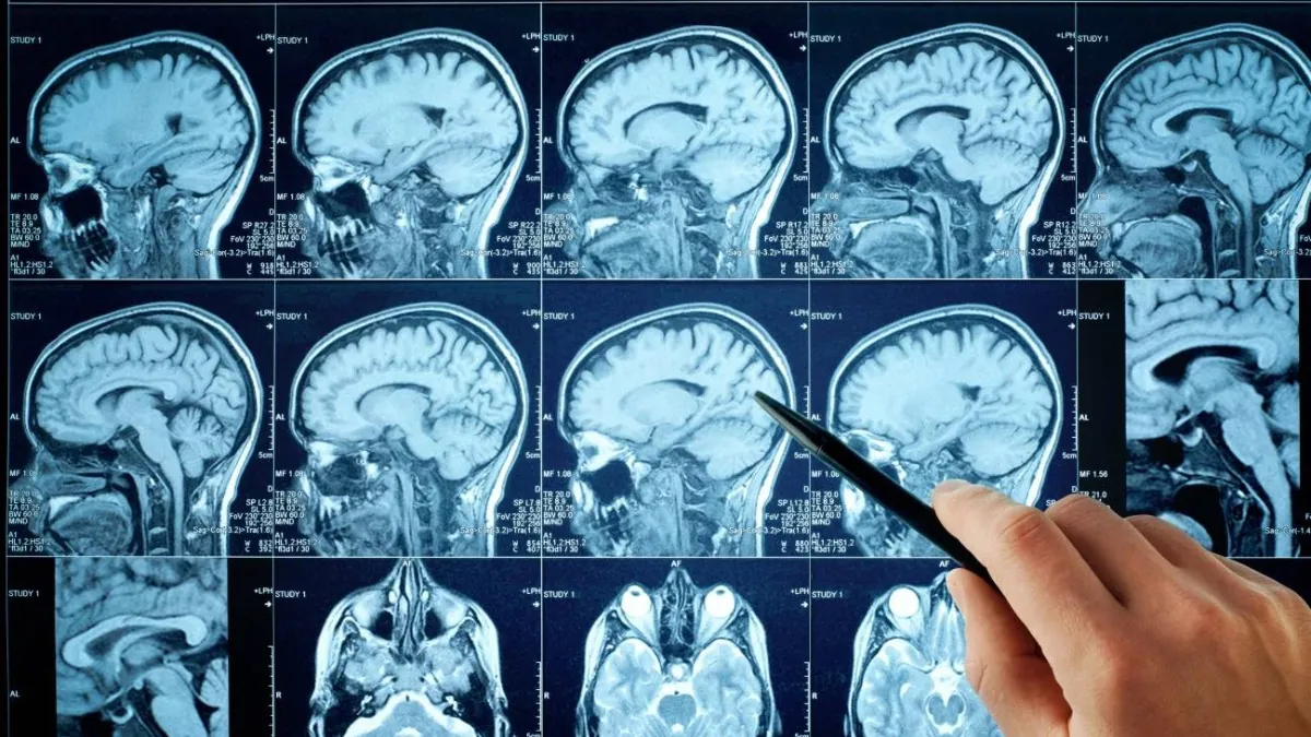 Identifican las señales cerebrales del olvido de recuerdos desagradables