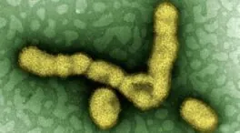 La gripe altera la microbiota pulmonar y potencia las infecciones secundarias