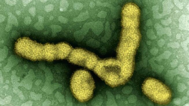 La gripe altera la microbiota pulmonar y potencia las infecciones secundarias