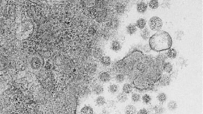 Una vacuna intranasal experimental elimina el virus de la covid-19 en ratones