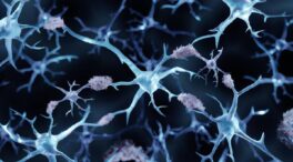 Consiguen revertir el alzhéimer en ratones con el uso de nanopartículas