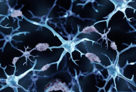 Consiguen revertir el alzhéimer en ratones con el uso de nanopartículas