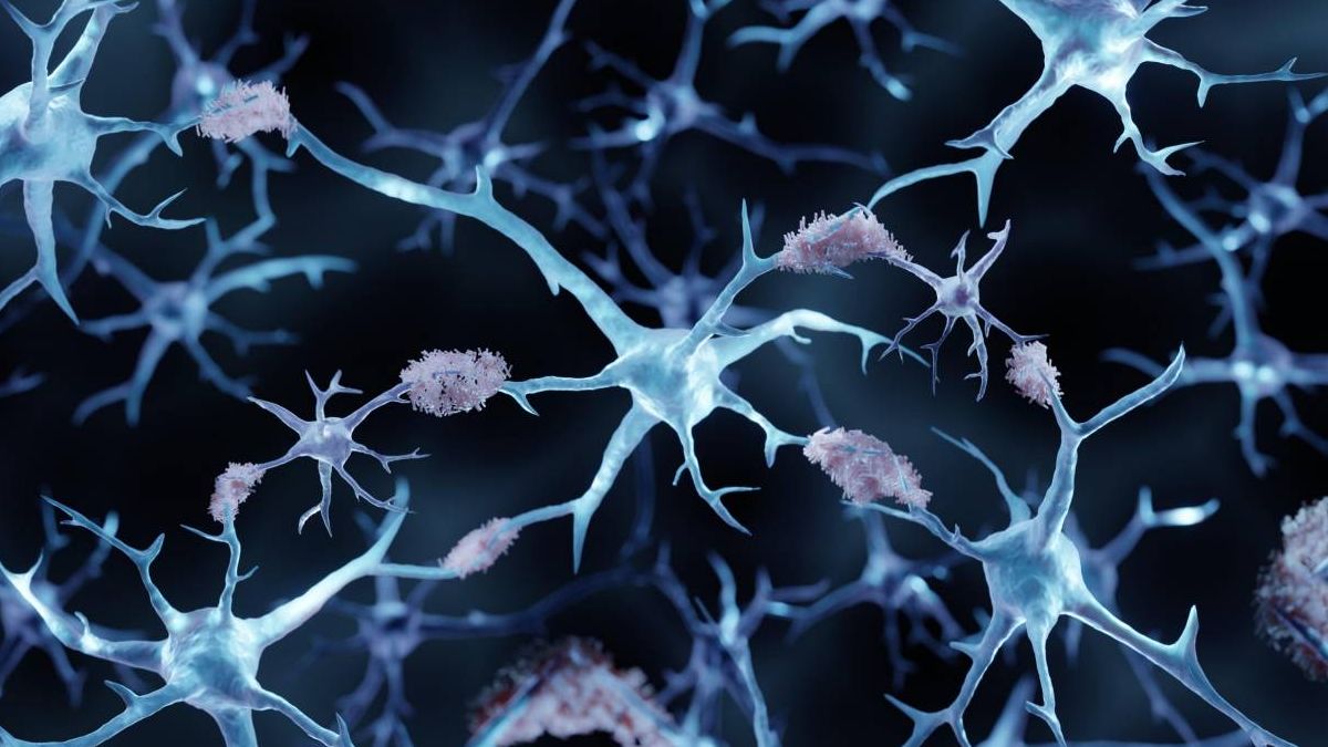 Consiguen revertir el alzhéimer en ratones con el uso de nanopartículas