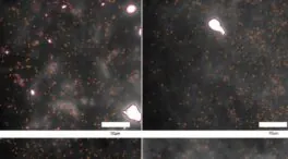 Observan por primera vez las ‘primeras huellas’ del párkinson en tejido cerebral
