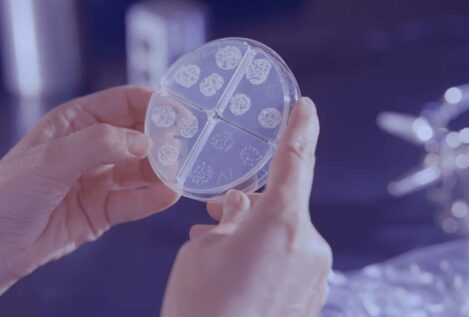Una de cada seis infecciones bacterianas en 2023 fueron resistentes a los antibióticos