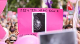 Cribados de mama: lo de Andalucía es solo el primer aviso de un problema nacional