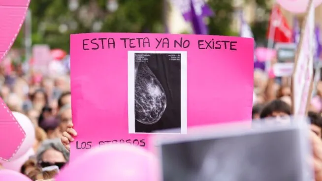 Cribados de mama: lo de Andalucía es solo el primer aviso de un problema nacional