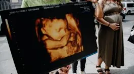 ¿Existe el «síndrome posaborto»? Los psiquiatras matizan, pero hay base científica