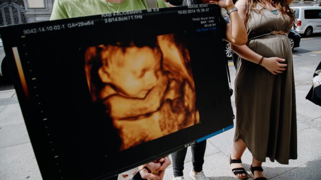 ¿Existe el «síndrome posaborto»? Los psiquiatras matizan, pero hay base científica