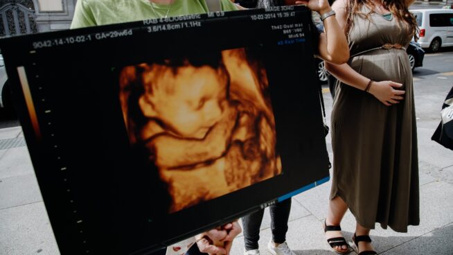 ¿Existe el «síndrome posaborto»? Los psiquiatras matizan, pero hay base científica