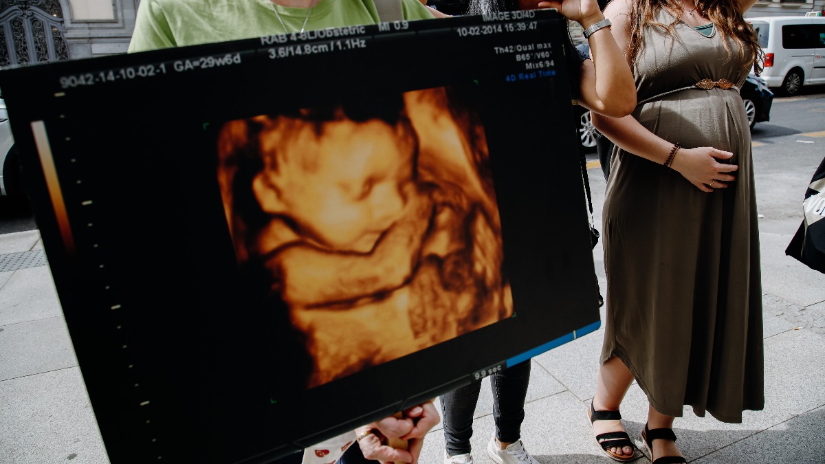 ¿Existe el «síndrome posaborto»? Los psiquiatras matizan, pero hay base científica