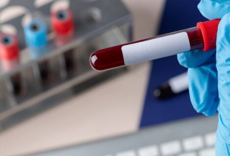 Un análisis genético de sangre para una detección precoz del párkinson