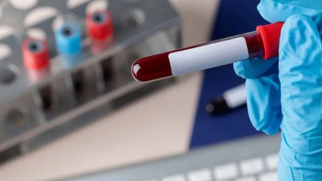 Un análisis genético de sangre para una detección precoz del párkinson