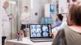 ASTUCE Spain alerta que pacientes con glioblastoma aún no acceden a TTFields