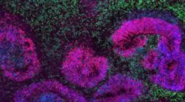 El mayor mapa del cerebro en desarrollo revela cuándo se originan los trastornos neurológicos