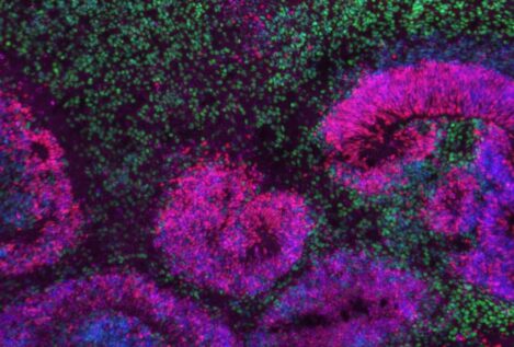 El mayor mapa del cerebro en desarrollo revela cuándo se originan los trastornos neurológicos