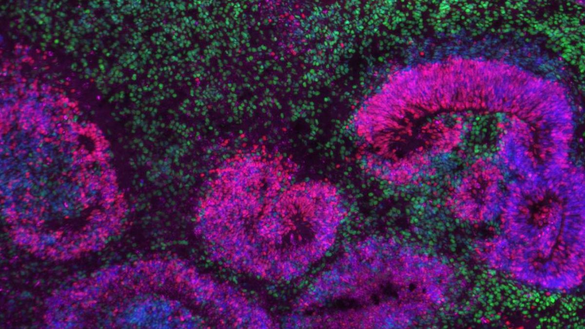 El mayor mapa del cerebro en desarrollo revela cuando se originan los trastornos neurológicos