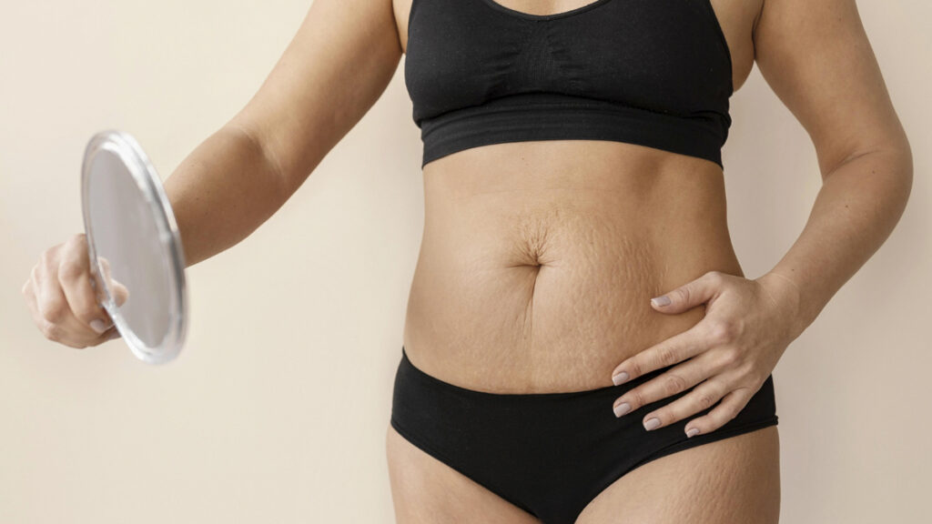 Hay que analizar cada cicatriz de manera individual. (Fuente: Freepik)