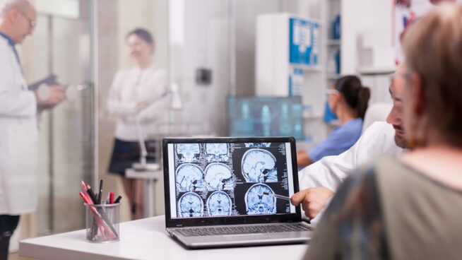 Una molécula de nuestro cuerpo podría ayudar a defendernos contra el Alzhéimer