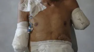 Médicos Sin Fronteras alerta de que cientos de miles de gazatíes sufrirán el veto a 37 ONG