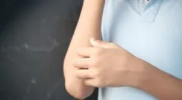 ¿Qué son las pegatinas plateadas que lleva la gente en el brazo?