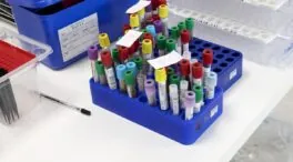 Un paciente VIH permanece años sin rebote viral tras un trasplante de células madre