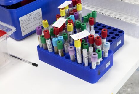 Un paciente VIH permanece años sin rebote viral tras un trasplante de células madre