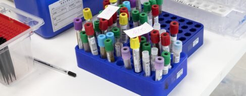 Un paciente VIH permanece años sin rebote viral tras un trasplante de células madre