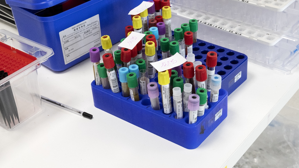 Un paciente VIH permanece años sin rebote viral tras un trasplante de células madre