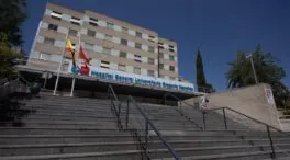 Médicos del Marañón salvan la pierna a un menor con 3D y un trasplante de adulto