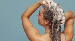 Mathy Urbin, tricóloga: «El champú de cebolla y el romero limpian el cuero cabelludo, pero no detienen la caída del pelo»