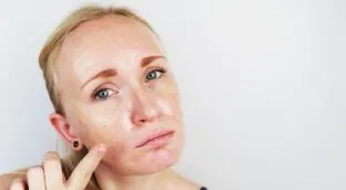 Paloma Borregón, dermatóloga madrileña: «Se puede tener una piel grasa y deshidratada»