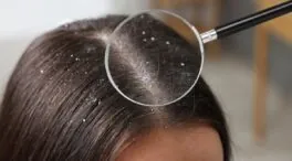 Isabel Barrado, peluquera: «El truco definitivo para combatir la caspa es utilizar un champú más respetuoso con el cuero cabelludo»