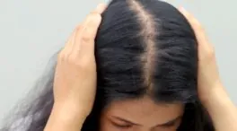 Elba Chimarro, médica estética, sobre la caída del pelo: «El hierro, el zinc y la vitamina D ayudan a que crezca más rápido y fuerte»