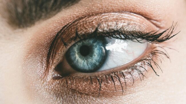 Sombras en los ojos: cuando un lunar en el párpado puede ser peligro