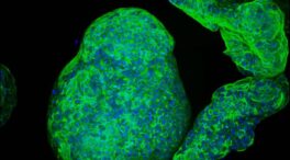 Crean organoides de páncreas cíborgs capaces de estimular la secreción de insulina