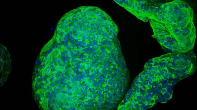 Crean organoides de páncreas cíborgs capaces de estimular la secreción de insulina