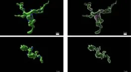 La fertilidad está relacionada con las células inmunitarias del cerebro
