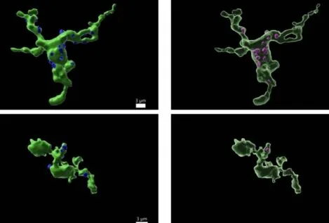 La fertilidad está relacionada con las células inmunitarias del cerebro