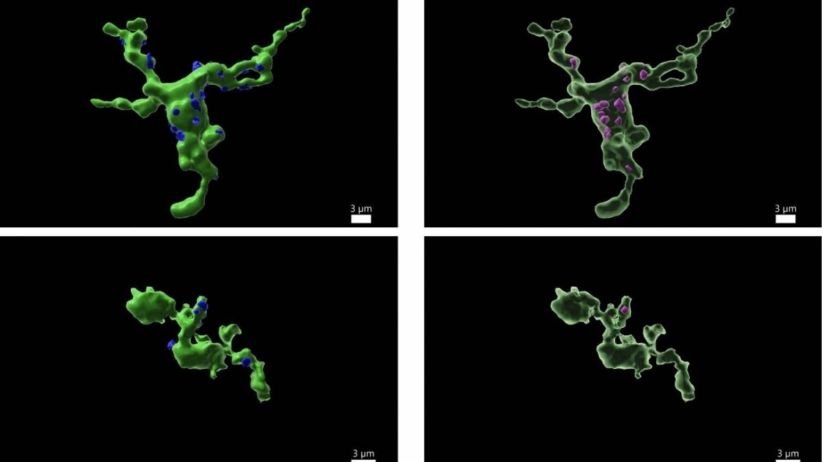 La fertilidad está relacionada con las células inmunitarias del cerebro