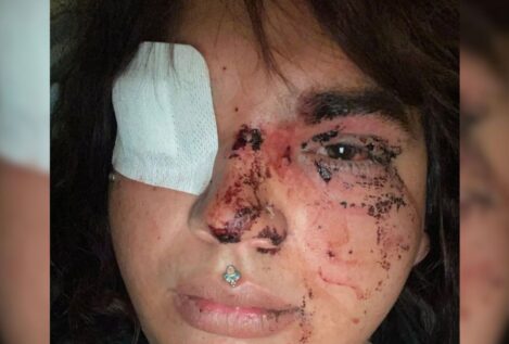 Una mujer transexual sufre una paliza a manos de un grupo de personas en La Bañeza (León)